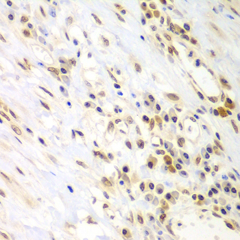 Immunohistochemistry - LHX4 Polyclonal Antibody 