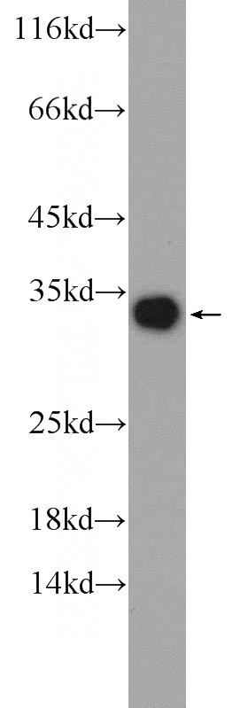 human blood tissue were subjected to SDS PAGE followed by western blot with Catalog No:112507(MBL2 antibody) at dilution of 1:1000