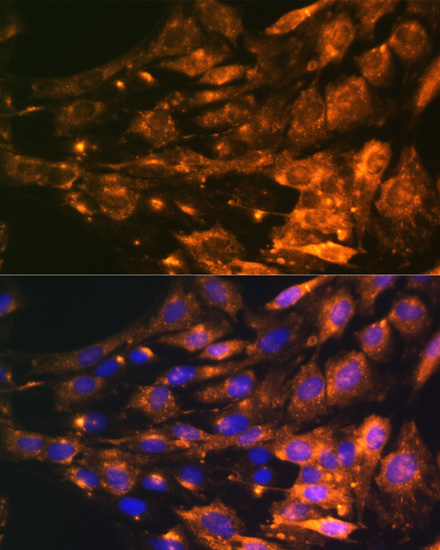 Immunofluorescence - PTCH1 Polyclonal Antibody 