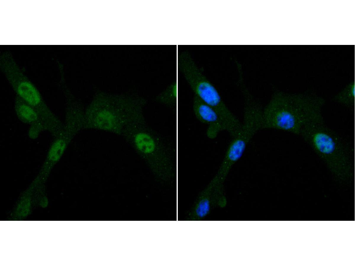 Fig3:; ICC staining of PDK1 in NIH/3T3 cells (green). Formalin fixed cells were permeabilized with 0.1% Triton X-100 in TBS for 10 minutes at room temperature and blocked with 1% Blocker BSA for 15 minutes at room temperature. Cells were probed with the primary antibody ( 1/50) for 1 hour at room temperature, washed with PBS. Alexa Fluor®488 Goat anti-Rabbit IgG was used as the secondary antibody at 1/1,000 dilution. The nuclear counter stain is DAPI (blue).