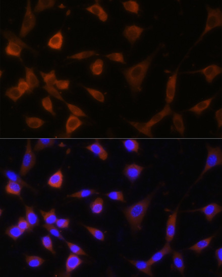 Immunofluorescence - GANAB Polyclonal Antibody 
