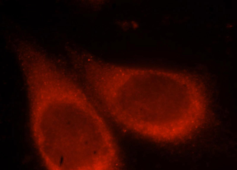 Immunofluorescent analysis of Hela cells, using PIK3R4 antibody Catalog No:116772 at 1:25 dilution and Rhodamine-labeled goat anti-rabbit IgG (red).