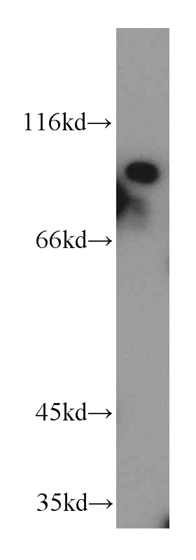 HepG2 cells were subjected to SDS PAGE followed by western blot with Catalog No:113484(PAF1 antibody) at dilution of 1:1000