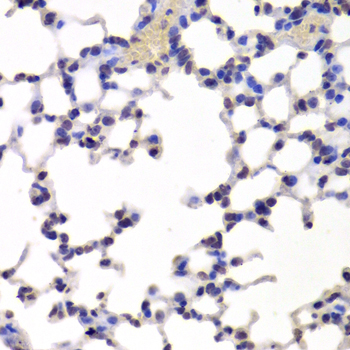 Immunohistochemistry - INTS6 Polyclonal Antibody 