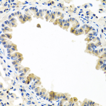 Immunohistochemistry - BMP5 Polyclonal Antibody 