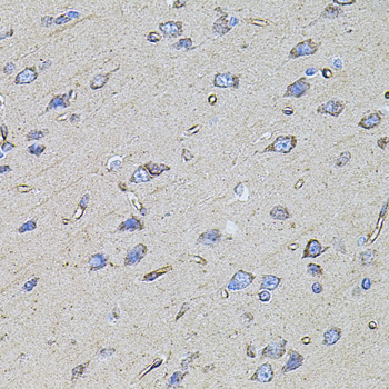 Immunohistochemistry - FLNB Polyclonal Antibody 