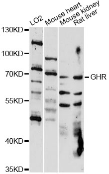 Western blot - GHR Polyclonal Antibody 
