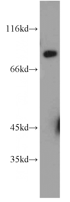 mouse lung tissue were subjected to SDS PAGE followed by western blot with Catalog No:115011(SCNN1G antibody) at dilution of 1:1200