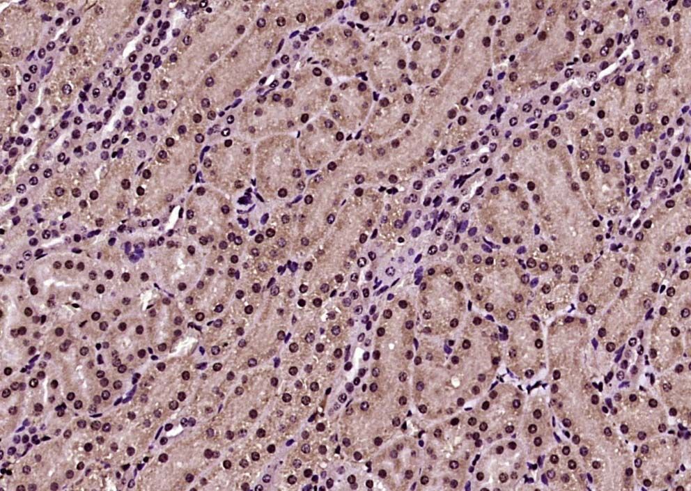 Fig2: Paraformaldehyde-fixed, paraffin embedded (Mouse kidney); Antigen retrieval by boiling in sodium citrate buffer (pH6.0) for 15min; Block endogenous peroxidase by 3% hydrogen peroxide for 20 minutes; Blocking buffer (normal goat serum) at 37℃ for 30min; Antibody incubation with (ESRP2) Polyclonal Antibody, Unconjugated at 1:400 overnight at 4℃, followed by operating according to SP Kit(Rabbit) (sp-0023) instructionsand DAB staining.