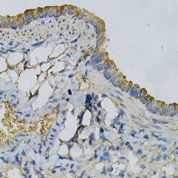 Immunohistochemistry - APRT Polyclonal Antibody 