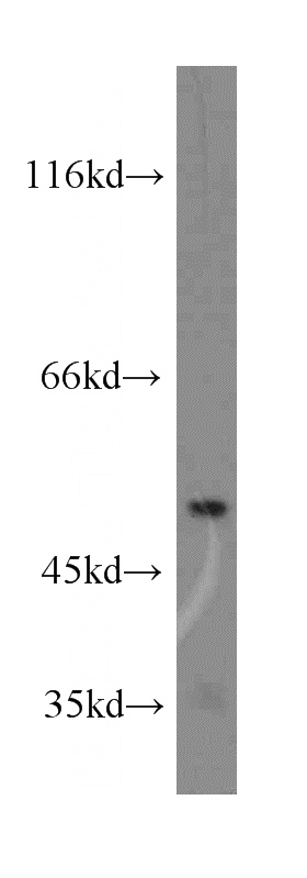 mouse heart tissue were subjected to SDS PAGE followed by western blot with Catalog No:109471(COQ6 antibody) at dilution of 1:200