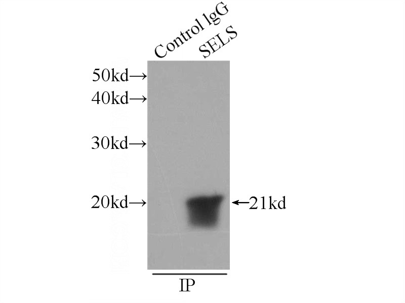 IP Result of anti-SELS (IP:Catalog No:115102, 3ug; Detection:Catalog No:115102 1:500) with HepG2 cells lysate 600ug.
