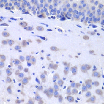 Immunohistochemistry - HTT Polyclonal Antibody 
