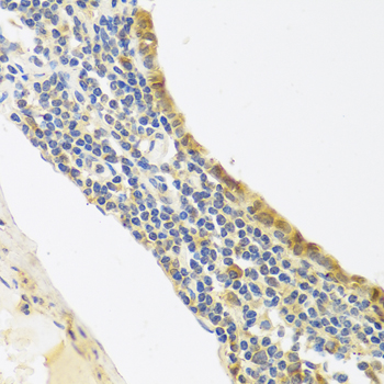 Immunohistochemistry - Endothelin 1 Polyclonal Antibody 