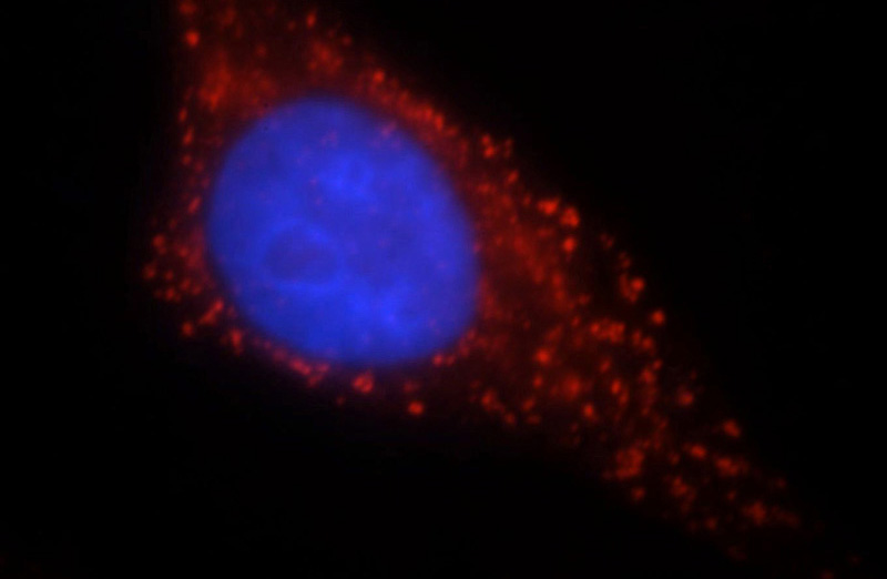 Immunofluorescent analysis of HepG2 cells, using DKK1 antibody Catalog No:109982 at 1:25 dilution and Rhodamine-labeled goat anti-rabbit IgG (red). Blue pseudocolor = DAPI (fluorescent DNA dye).