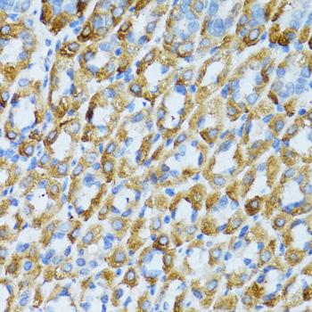 Immunohistochemistry - PSRC1 Polyclonal Antibody 