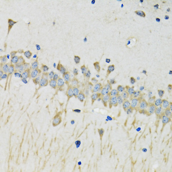 Immunohistochemistry - SERPINA4 Polyclonal Antibody 