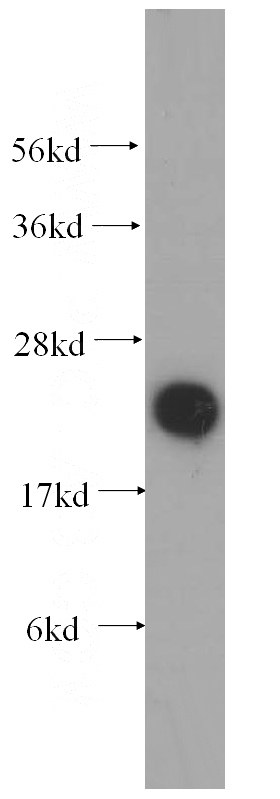 mouse liver tissue were subjected to SDS PAGE followed by western blot with Catalog No:109472(COQ7 antibody) at dilution of 1:500