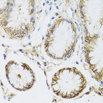 Immunohistochemistry - ATP1A Polyclonal Antibody 