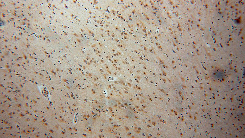 Immunohistochemical of paraffin-embedded human brain using Catalog No:109886(DEK antibody) at dilution of 1:100 (under 10x lens)