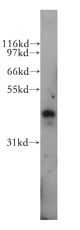 human lung tissue were subjected to SDS PAGE followed by western blot with Catalog No:113615(PBX3 antibody) at dilution of 1:500