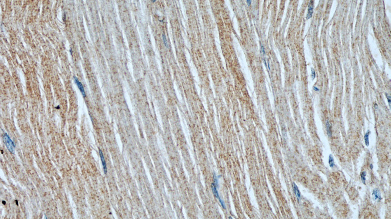 Immunohistochemical of paraffin-embedded human skeletal muscle using Catalog No:107492(RAB27A antibody) at dilution of 1:50 (under 40x lens)