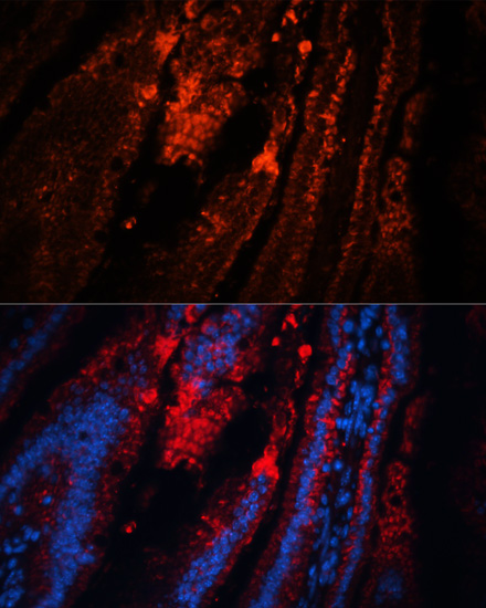 Immunofluorescence - TRPA1 Polyclonal Antibody 