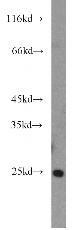 human testis tissue were subjected to SDS PAGE followed by western blot with Catalog No:107859(ALKBH7 antibody) at dilution of 1:500