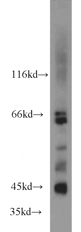 mouse brain tissue were subjected to SDS PAGE followed by western blot with Catalog No:112430(MAPK10 antibody) at dilution of 1:1000