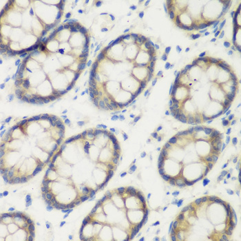 Immunohistochemistry - TGM5 Polyclonal Antibody 