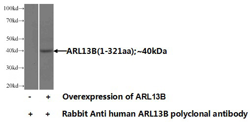 Transfected HEK-293 cells were subjected to SDS PAGE followed by western blot with Catalog No:108196(ARL13B Antibody) at dilution of 1:1000