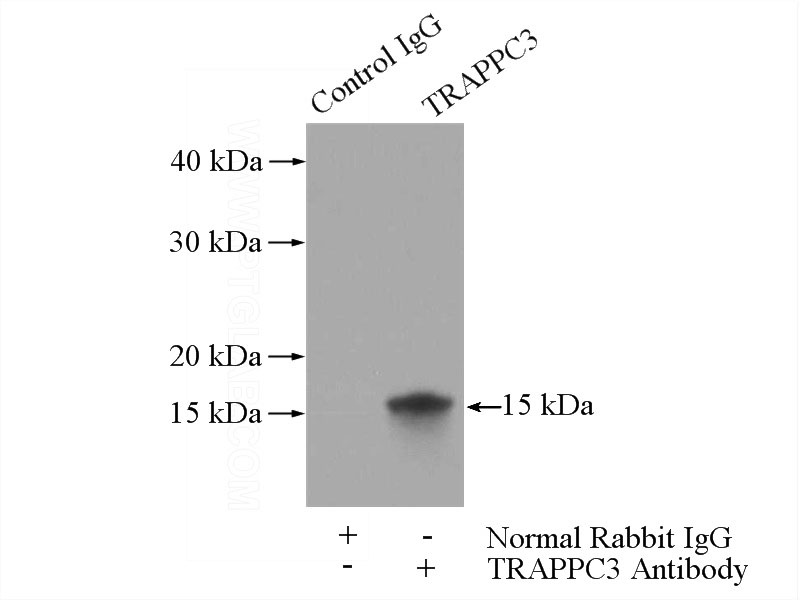 IP Result of anti-TRAPPC3 (IP:Catalog No:116344, 3ug; Detection:Catalog No:116344 1:800) with mouse liver tissue lysate 4000ug.