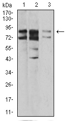 Fig3: Western blot analysis of IL1RAPL1 on different cell lysate using anti-IL1RAPL1 antibody at 1/1,000 dilution.; Positive control:; Lane 1: A431; Lane 2: SK-Hep-1; Lane 3: HL-7702