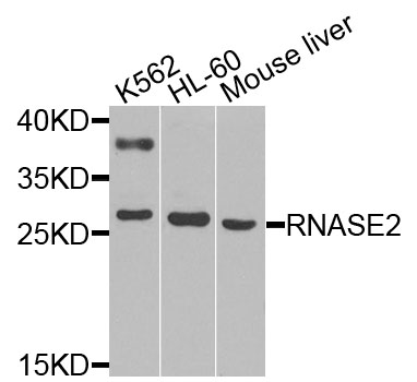 Western blot - RNASE2 Polyclonal Antibody 