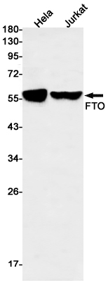Western blot detection of FTO in Hela,Jurkat cell lysates using FTO Rabbit mAb(1:500 diluted).Predicted band size:58kDa.Observed band size:58kDa.