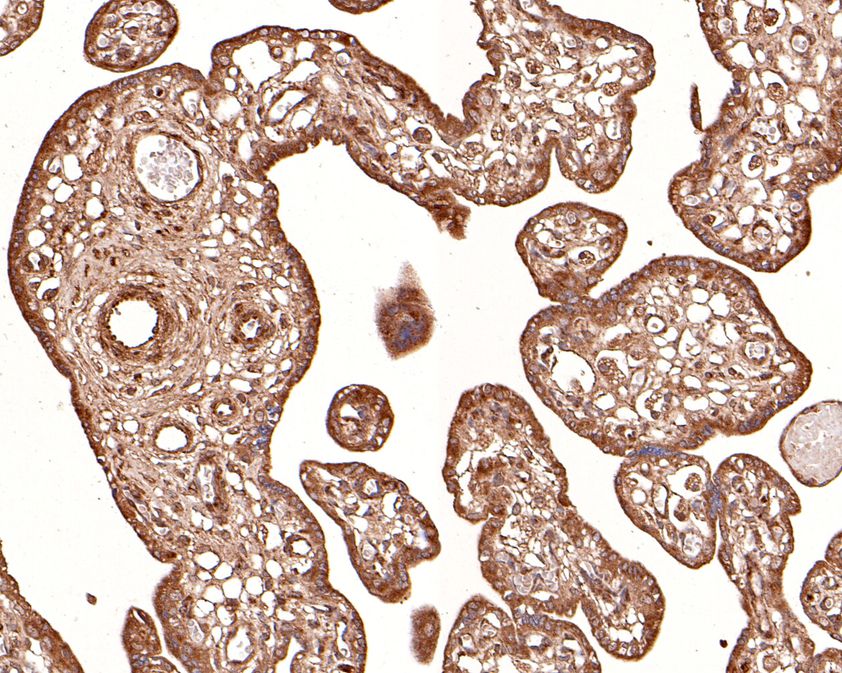 Fig2:; Immunohistochemical analysis of paraffin-embedded human placenta tissue using anti-RNF111 antibody. The section was pre-treated using heat mediated antigen retrieval with Tris-EDTA buffer (pH 9.0) for 20 minutes.The tissues were blocked in 1% BSA for 30 minutes at room temperature, washed with ddH; 2; O and PBS, and then probed with the primary antibody ( 1/100) for 30 minutes at room temperature. The detection was performed using an HRP conjugated compact polymer system. DAB was used as the chromogen. Tissues were counterstained with hematoxylin and mounted with DPX.