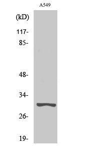 Fig1:; Western Blot analysis of various cells using Trypsin-3 Polyclonal Antibody. Secondary antibody（catalog#: HA1001) was diluted at 1:20000
