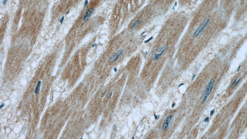 Immunohistochemical of paraffin-embedded human heart using Catalog No:110815(GAC-specific antibody) at dilution of 1:50 (under 40x lens)