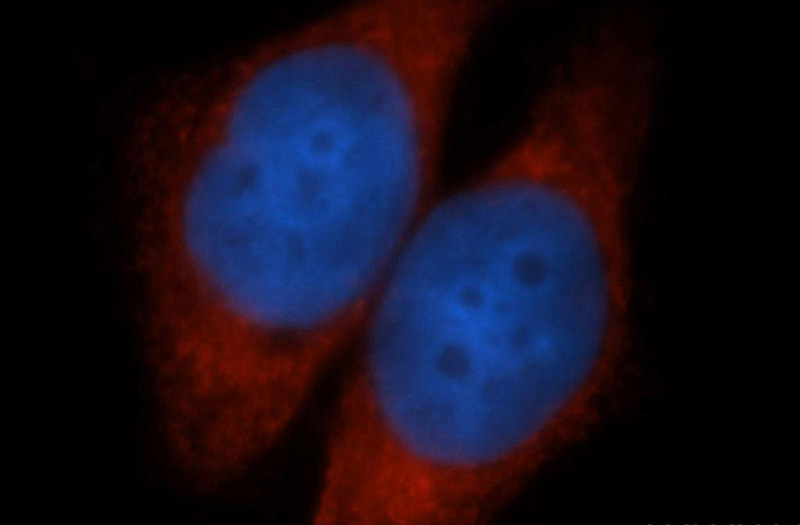 Immunofluorescent analysis of MCF-7 cells, using MTDH antibody Catalog No:107899 at 1:50 dilution and Rhodamine-labeled goat anti-rabbit IgG (red). Blue pseudocolor = DAPI (fluorescent DNA dye).