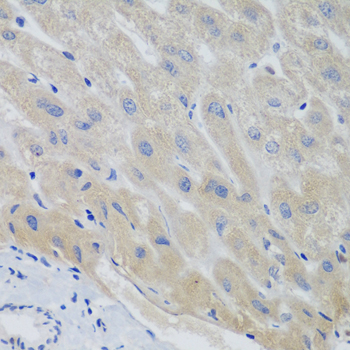Immunohistochemistry - PTTG1 Polyclonal Antibody 