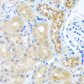 Immunohistochemistry - RPS2 Polyclonal Antibody 
