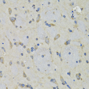 Immunohistochemistry - RAE1 Polyclonal Antibody 