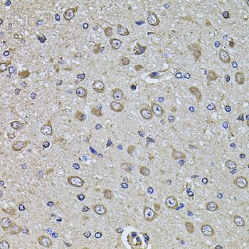 Immunohistochemistry - EPHA3 Polyclonal Antibody 