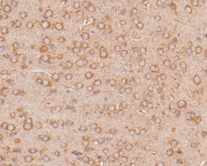 Fig5:; Immunohistochemical analysis of paraffin-embedded mouse brain tissue using anti-Neurabin 1 antibody. The section was pre-treated using heat mediated antigen retrieval with Tris-EDTA buffer (pH 8.0-8.4) for 20 minutes.The tissues were blocked in 5% BSA for 30 minutes at room temperature, washed with ddH; 2; O and PBS, and then probed with the primary antibody ( 1/400) for 30 minutes at room temperature. The detection was performed using an HRP conjugated compact polymer system. DAB was used as the chromogen. Tissues were counterstained with hematoxylin and mounted with DPX.