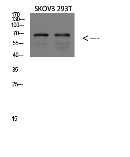 Fig1:; Western blot analysis of MOUSE-BRAIN lysate, antibody was diluted at 1000. Secondary antibody（catalog#: HA1001) was diluted at 1:20000