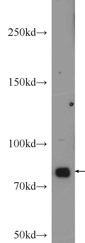 mouse heart tissue were subjected to SDS PAGE followed by western blot with Catalog No:110857(JUP Antibody) at dilution of 1:1000