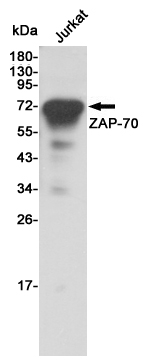 Western blot detection of ZAP-70 in Jurkat cell lysates using ZAP-70 mouse mAb (1:1000 diluted).Predicted band size:70KDa.Observed band size:70KDa.