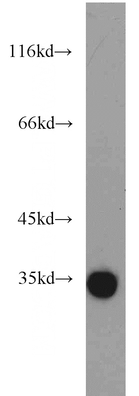 mouse liver tissue were subjected to SDS PAGE followed by western blot with Catalog No:114638(RGN,SMP30 antibody) at dilution of 1:1000