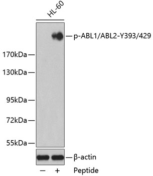 Western blot - Phospho-ABL1-Y393/ABL2-Y429 pAb 