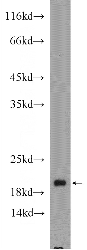 mouse brain tissue were subjected to SDS PAGE followed by western blot with Catalog No:108246(ARF4 Antibody) at dilution of 1:800